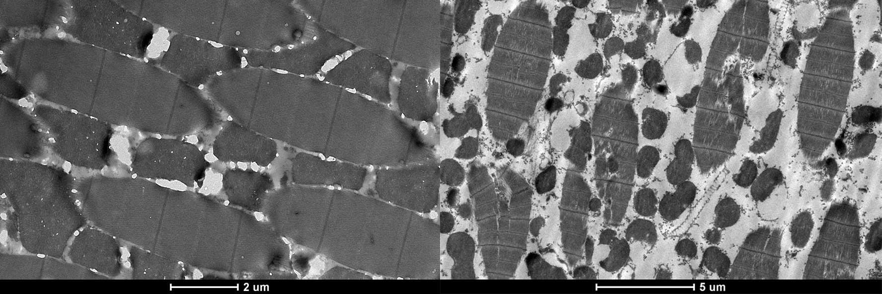 mosquito flight muscle comparison Deformed muscles seen in females with the edited Act4 gene showing large defects in the muscle fibres (left) alongside non-edited female muscles that have formed normally.