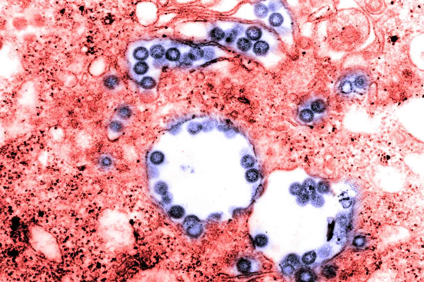 False coloured electron micrograph of Rift Valley fever virus False coloured electron micrograph of Rift Valley fever virus