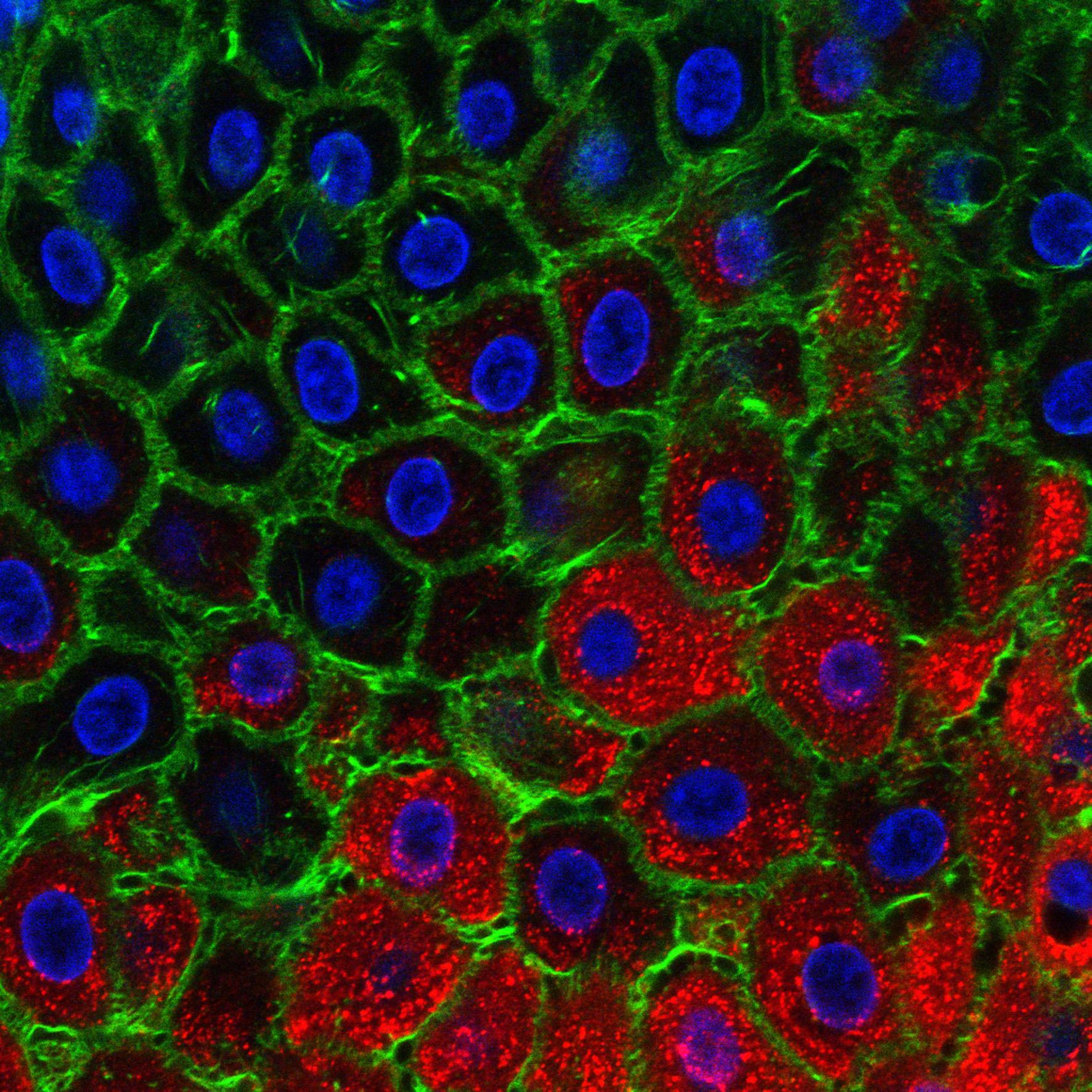 Foot-and-mouth disease EM image Foot-and-mouth disease